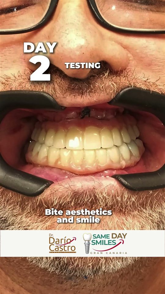Patient's new smile after a three-day treatment